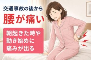 交通事故後から腰が痛くなり、朝起きた時や動き始めに腰痛を感じる40代女性のイラスト
